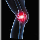 Iniezione ortopedica dei prodotti &amp; iniezione del ginocchio dell'acido ialuronico dello strumento di puntura