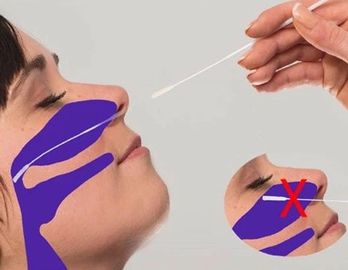 3ml NP affollati tamponano
